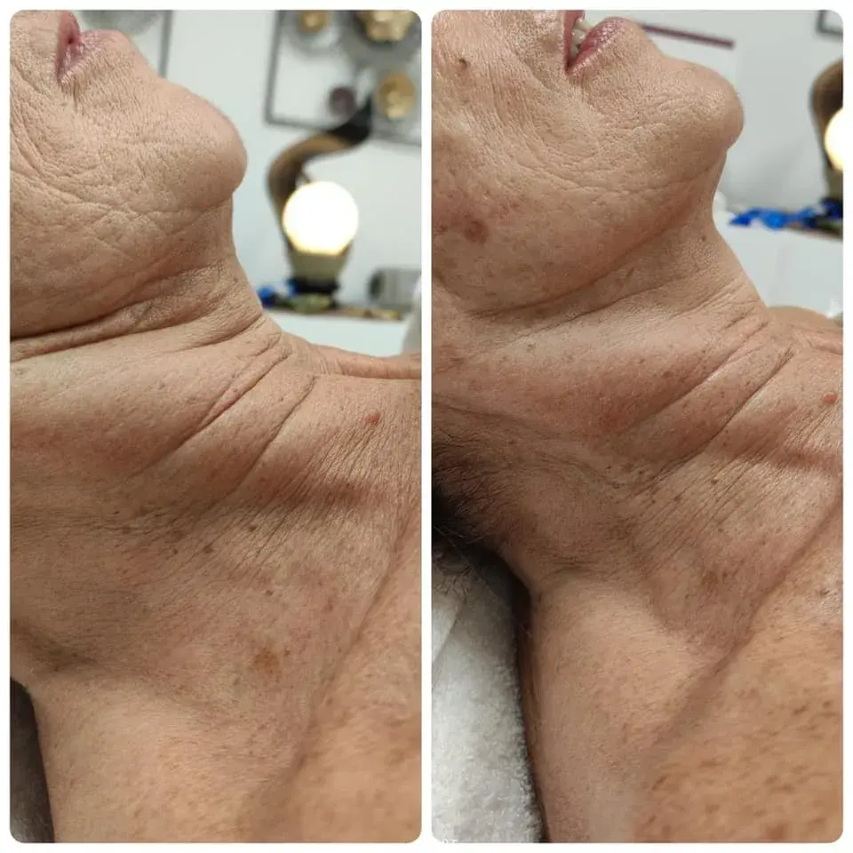 A Blue Rose client, before and after