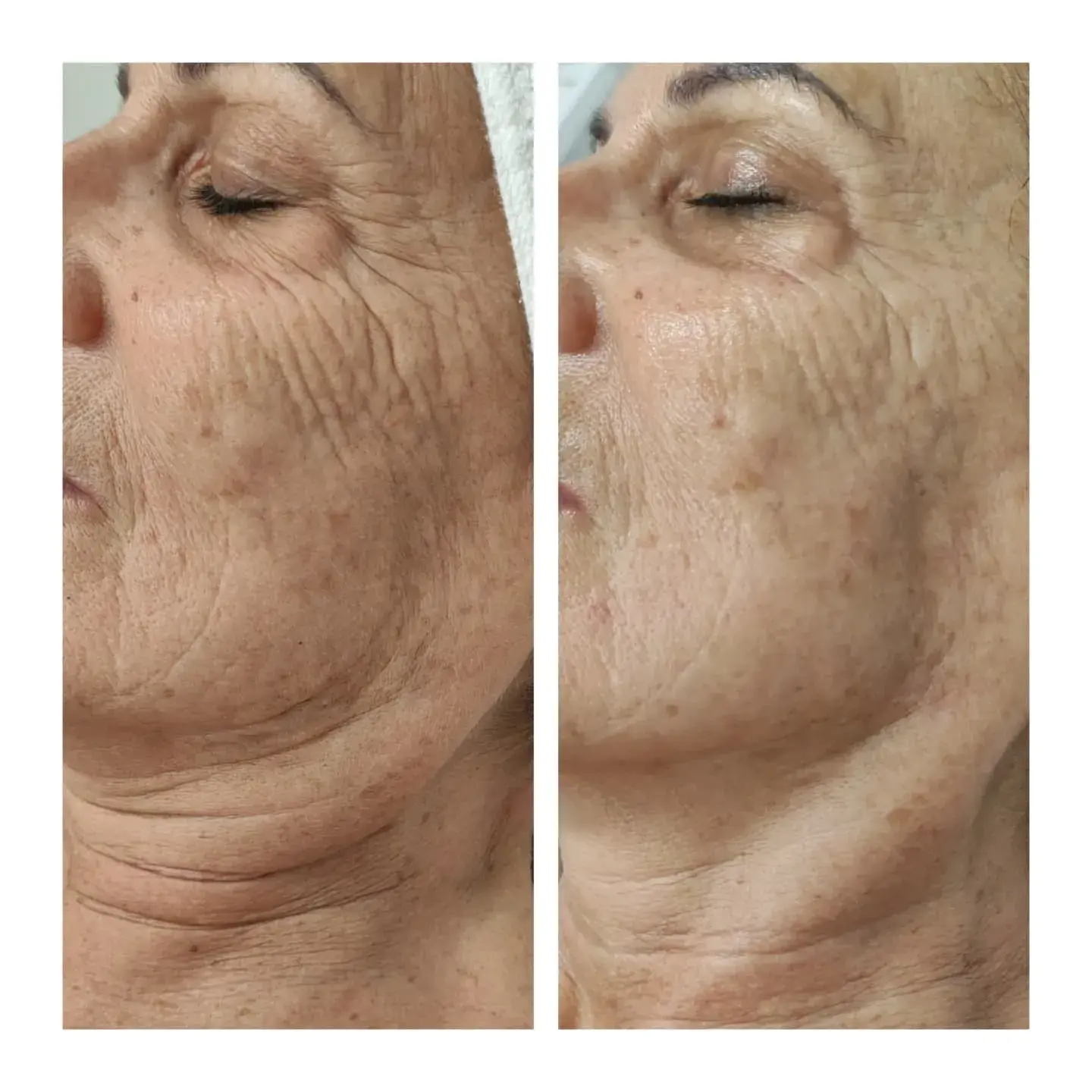 A Blue Rose client, before and after