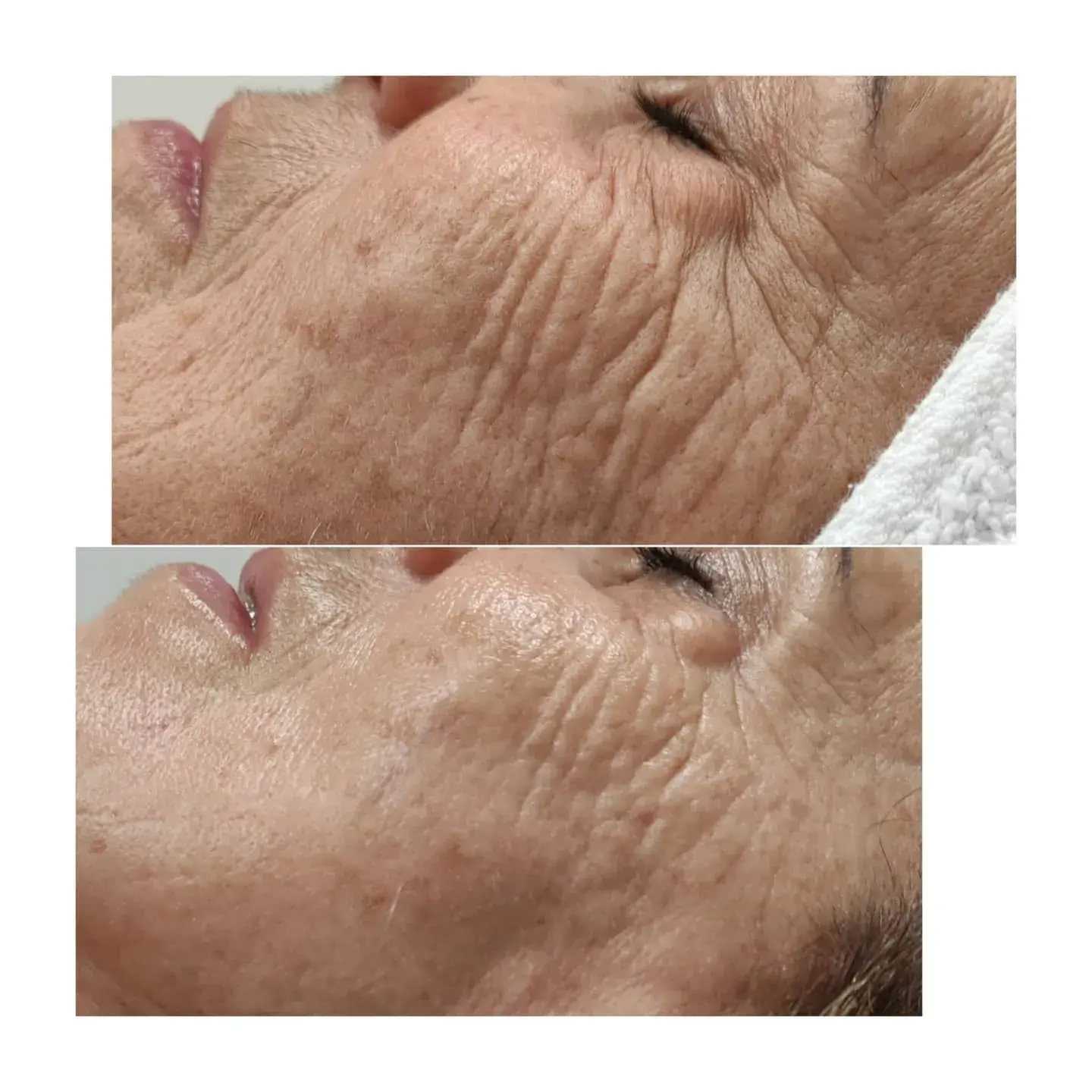 A Blue Rose client, before and after