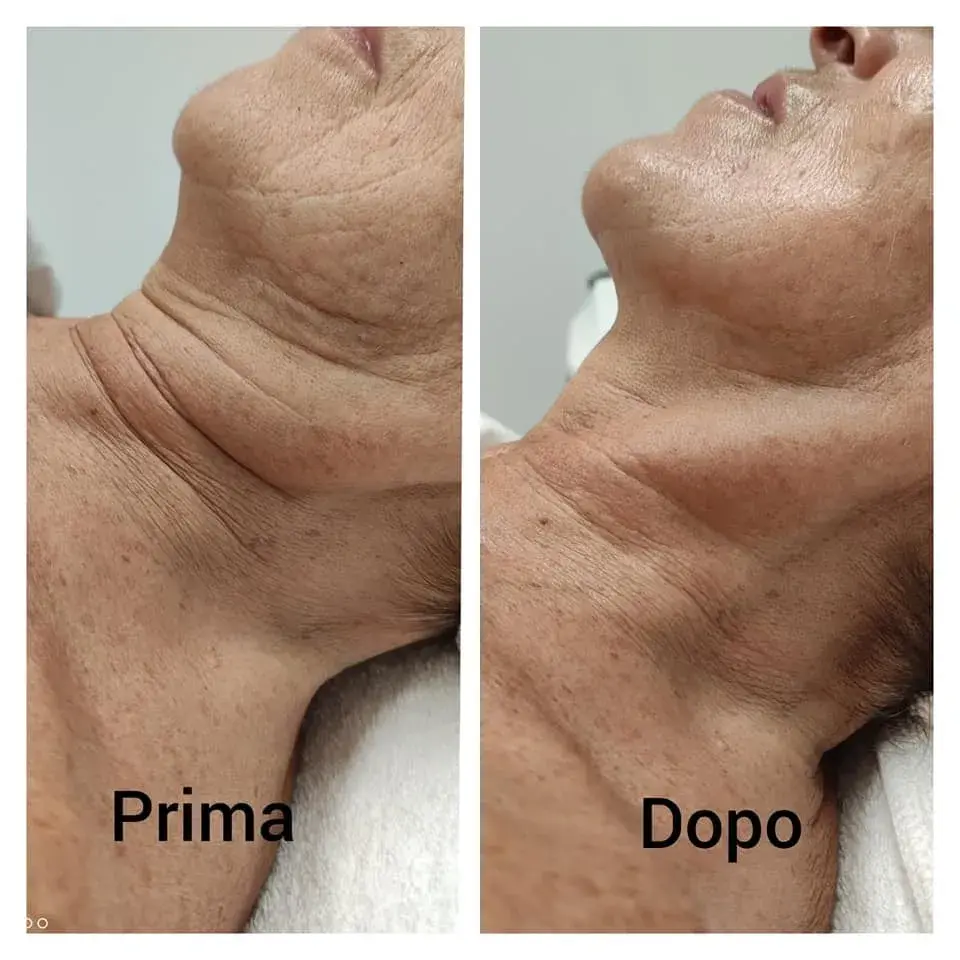 A Blue Rose client, before and after