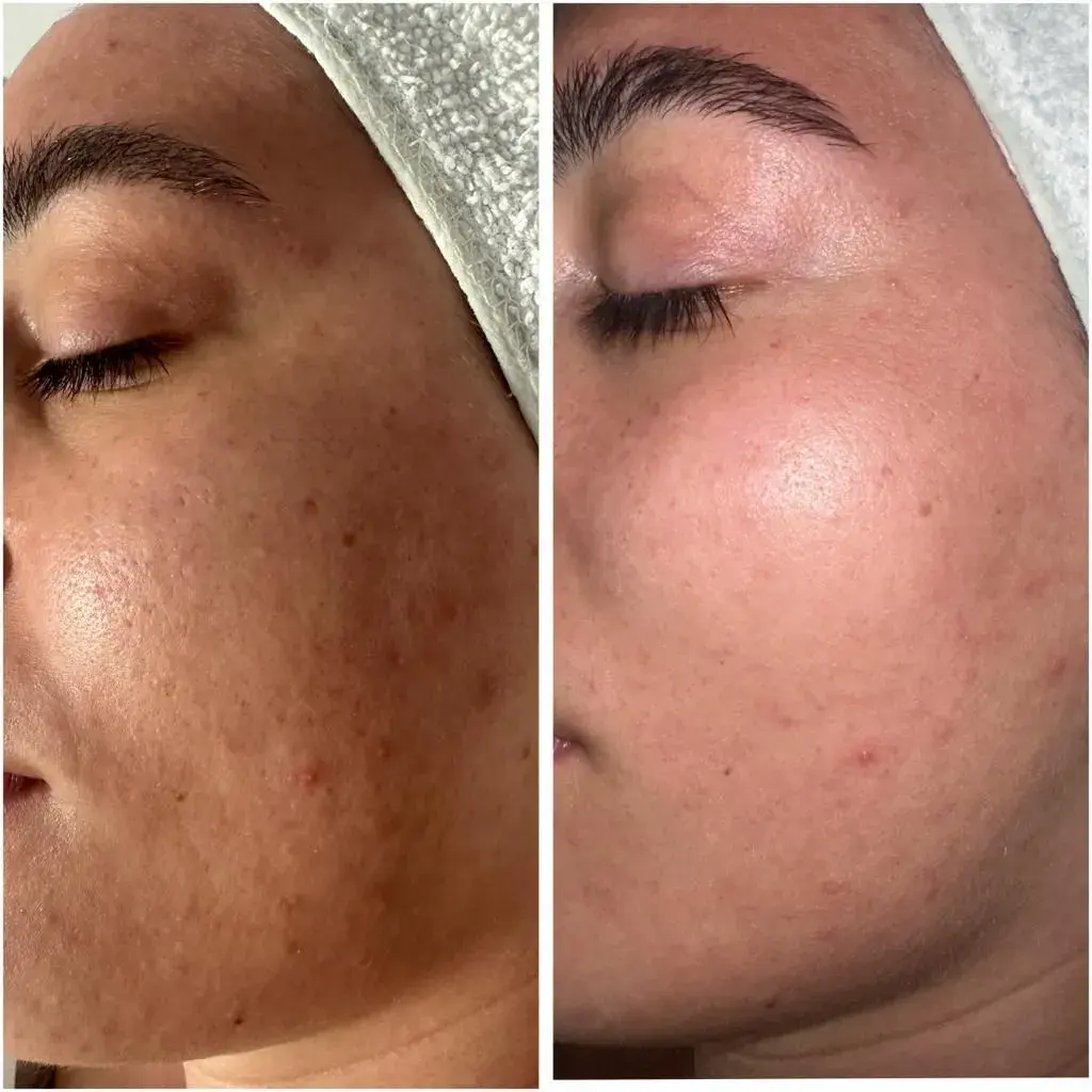 A Blue Rose client, before and after