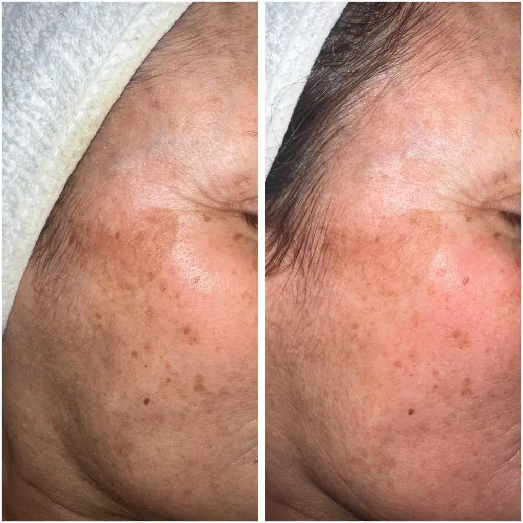 A Blue Rose client, before and after