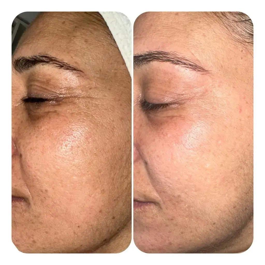 A Blue Rose client, before and after