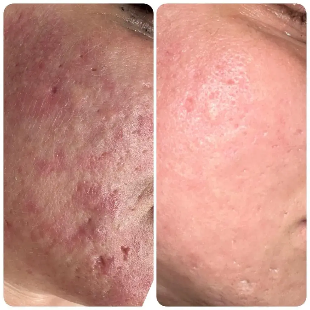 A Blue Rose client, before and after